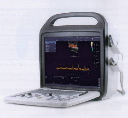 Full Digital Color Doppler Ultrasound Scanner