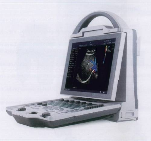 Full Digital Color Doppler Ultrasound Scanner